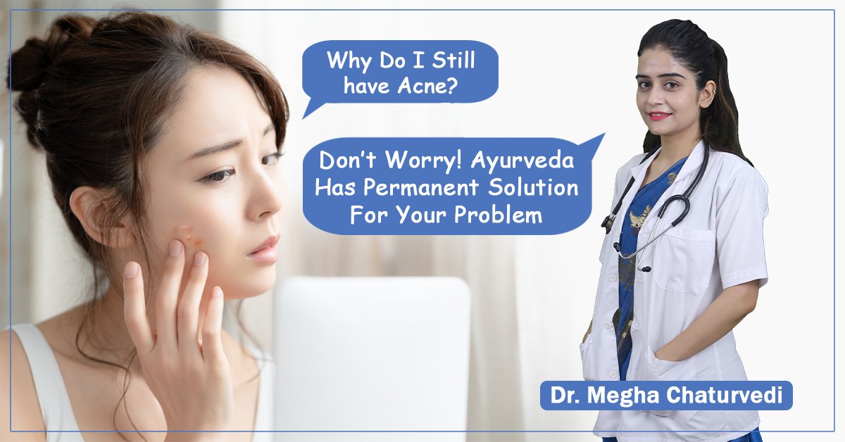 Causes of Acne: तनाव ही नहीं इन 5 कारणों से भी होते हैं मुहांसे, जानिये कैसे रखें अपनी स्किन को Acne Free