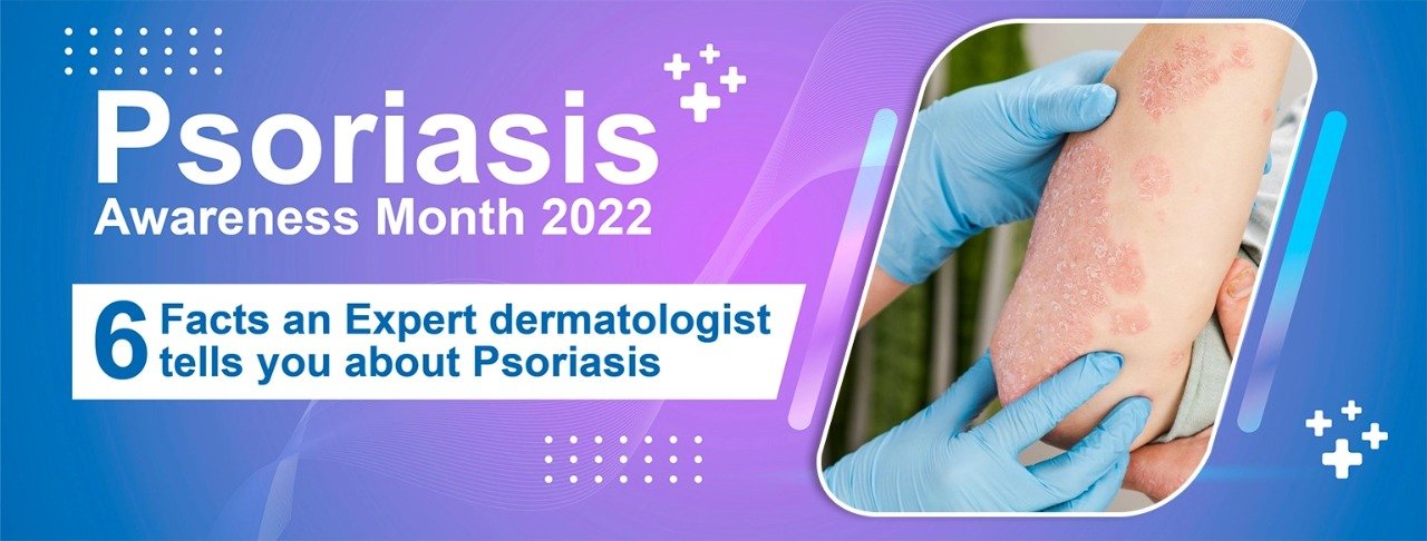 Psoriasis Awareness Month 2022: 6 Facts An Expert Dermatologist Tells You About Psoriasis.