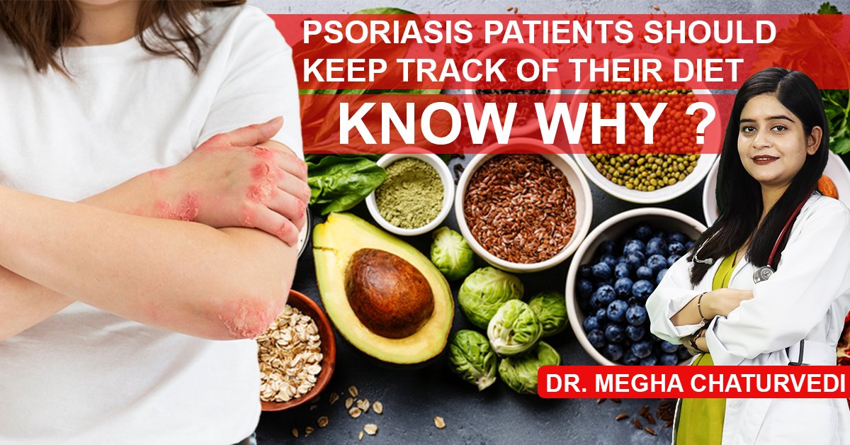 Have You Ever Wondered Why Psoriasis Patients Are Asked To keep track of Their Diet? 