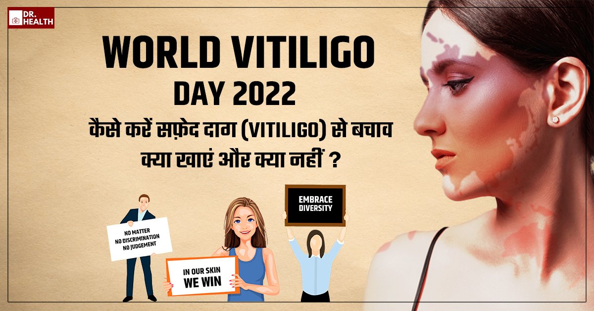 World Vitiligo Day 2022: कैसे करें सफ़ेद दाग (Vitiligo) से बचाव, क्या खाएं और क्या नहीं?